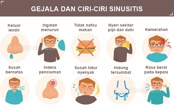 gejala sinusitis