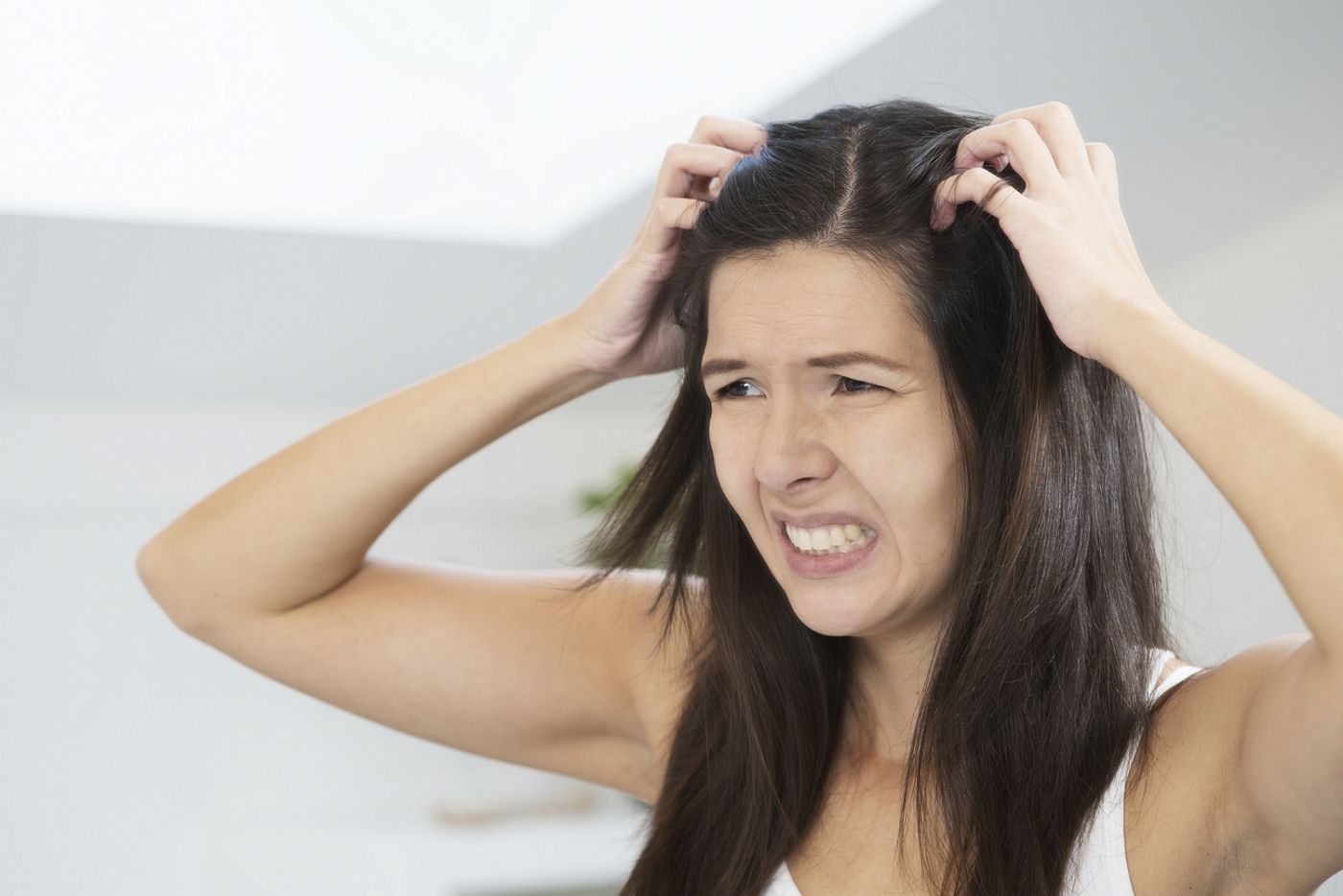 11 Cara Menghilangkan Kutu Rambut Dengan Cepat 100 Alami