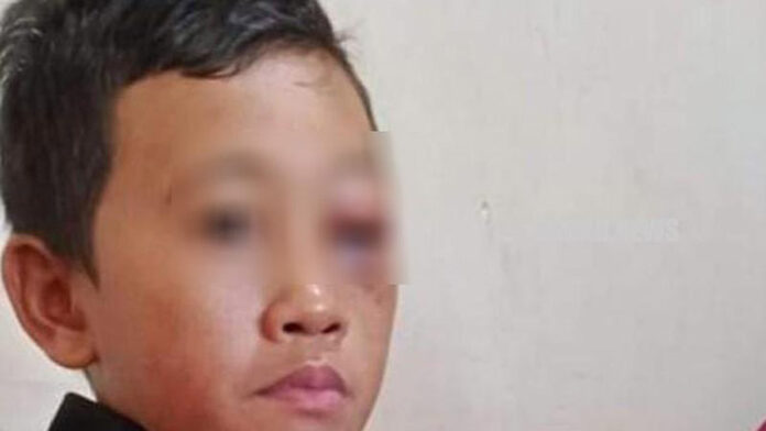 Bocah Korban Salah Tangkap Babak Belur Dihajar Polisi Bilang Tidak Sengaja Bocah Korban Salah Tangkap Babak Belur Dihajar Polisi Bilang Tidak Sengaja